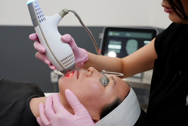 LaserAway Pasadena