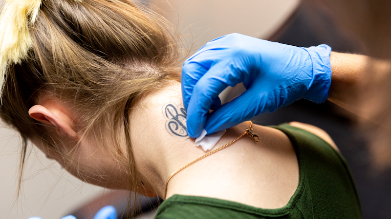 LIGHTEN UP Laser Clinic of NE Houston