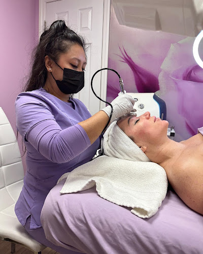 Eureka Body Care and Spa + Medspa, Botox